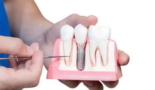 رشد مجدد دندان در بزرگسالی ممکن است!